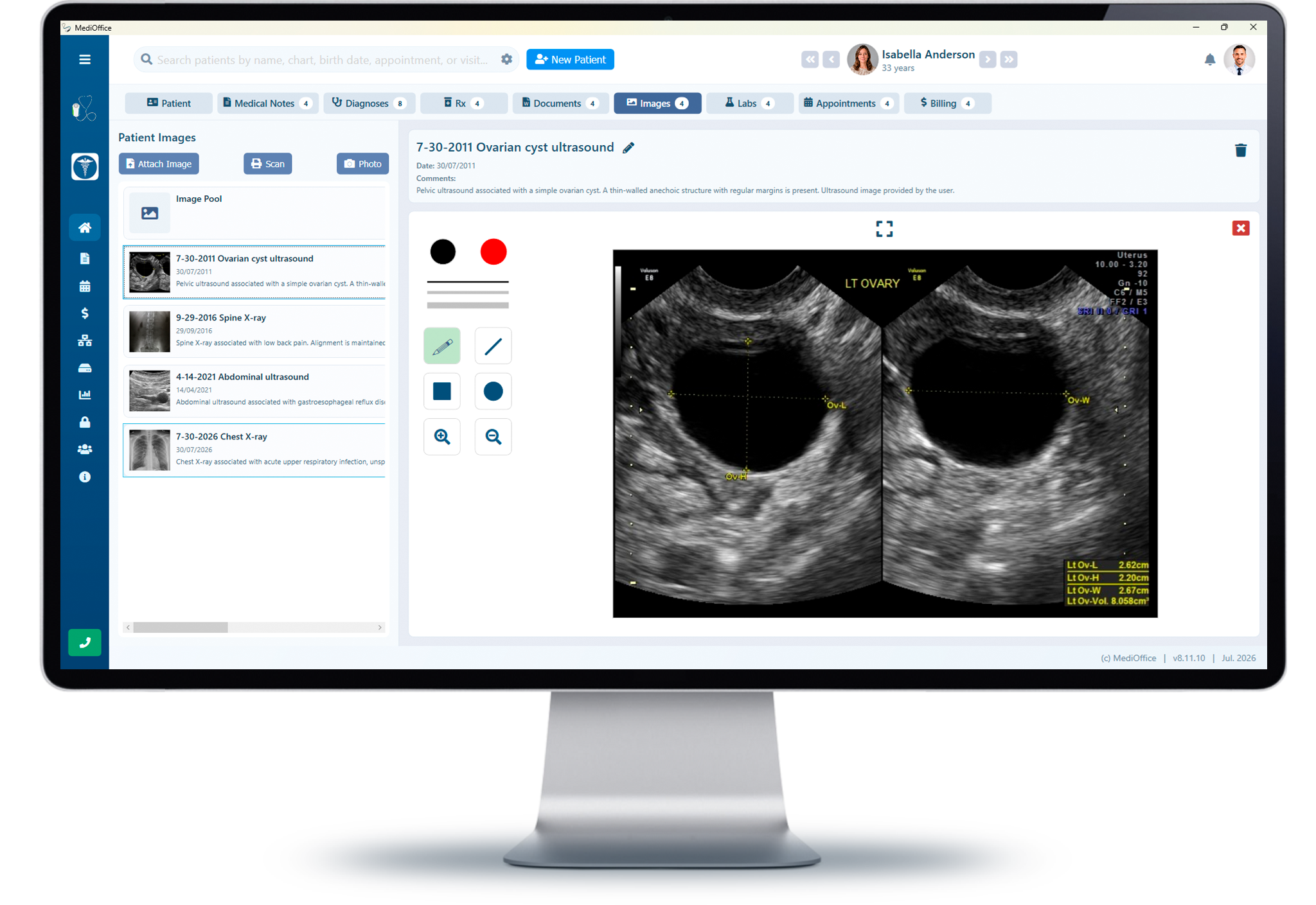Clinical images and drawing tools integrated into MediOffice